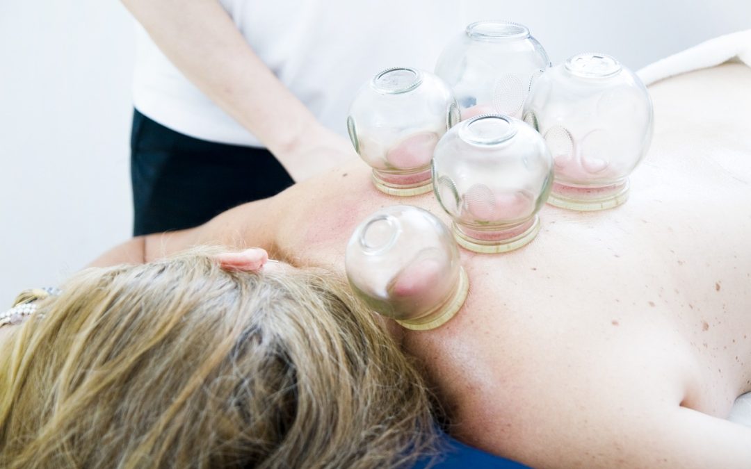 Alleviating Muscle Pain: The Power of Acupuncture and Cupping Massage