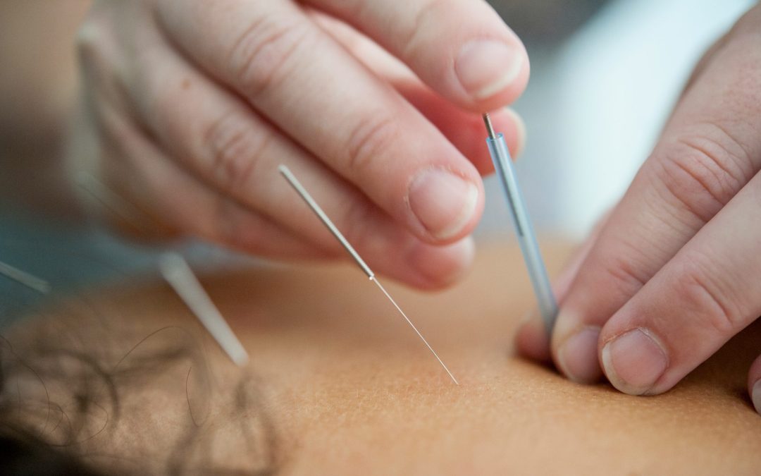 Enhancing IVF Success with Acupuncture: A Holistic Approach to Fertility